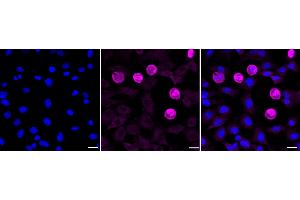 Immunocytochemical staining of C2C12 cells with Fibroblast growth factor 21 antibody (ABIN7798606), 1:1,000). (Recombinant FGF21 抗体)