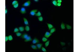 Immunofluorescence staining of Hela cells with ABIN7152321 at 1:100, counter-stained with DAPI. (Exportin 2 抗体  (AA 713-971))