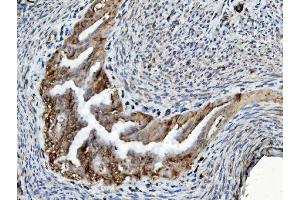 IHC analysis of PDIA6 using anti-PDIA6 antibody (ABIN7600553). (PDIA6 抗体  (AA 20-440))
