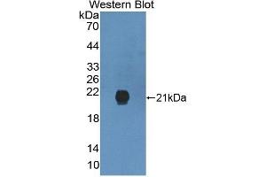 Detection of Recombinant GREM2, Human using Polyclonal Antibody to Gremlin 2 (GREM2) (GREM2 抗体  (AA 22-168))