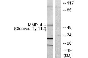 Western Blotting (WB) image for anti-Matrix Metallopeptidase 14 (Membrane-inserted) (MMP14) (Cleaved-Tyr112) antibody (ABIN1853592) (MMP14 抗体  (Cleaved-Tyr112))
