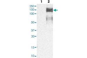 Western blot analysis of Lane 1: Human cell line RT-4; Lane 2: Human cell line U-251MG sp with ZEB1 polyclonal antibody  at 1:250-1:500 dilution. (ZEB1 抗体)