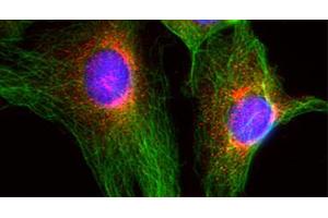Indirect immunofluorescence on 3T3 cells (dilution 1 : 100; red) in combination with the monoclonal antibody against α-tubulin (, dilution 1 : 500; green).
