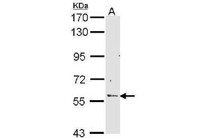 Western Blotting (WB) image for anti-Regulator of Chromosome Condensation (RCC1) and BTB (POZ) Domain Containing Protein 2 (RCBTB2) antibody (ABIN2856868)