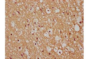 IHC image of ABIN7175445 diluted at 1:200 and staining in paraffin-embedded human brain tissue performed on a Leica BondTM system. (PTPLAD1 抗体  (AA 1-145))