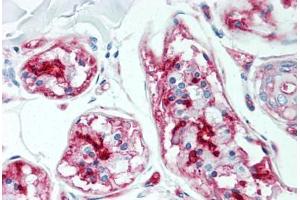 Human Skin, Sweat Glands (formalin-fixed, paraffin-embedded) stained with CD59 antibody ABIN298471 at 5 ug/ml followed by biotinylated anti-mouse IgG secondary antibody ABIN481714, alkaline phosphatase-streptavidin and chromogen. (CD59 抗体)