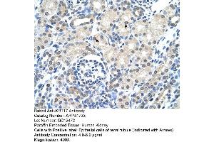 Rabbit Anti-KRT17 Antibody  Paraffin Embedded Tissue: Human Kidney Cellular Data: Epithelial cells of renal tubule Antibody Concentration: 4. (KRT17 抗体  (C-Term))