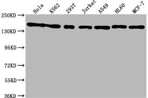 Western Blot Positive WB detected in: Hela whole cell lysate, K562 whole cell lysate, 293T whole cell lysate, Jurkat whole cell lysate, A549 whole cell lysate, HL60 whole cell lysate, MCF-7 whole cell lysate All lanes: SMC1A antibody at 1:1500 Secondary Goat polyclonal to rabbit IgG at 1/50000 dilution Predicted band size: 144 kDa Observed band size: 144 kDa (Recombinant SMC1A 抗体)
