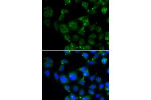 Immunofluorescence analysis of HeLa cells using MAPRE2 antibody (ABIN5974001). (MAPRE2 抗体)