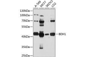 Western blot analysis of extracts of various cell lines, using BDH1 antibody (ABIN1678849, ABIN3018068, ABIN3018069 and ABIN6220349) at 1:1000 dilution. (BDH1 抗体  (AA 1-343))