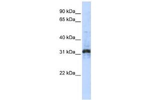 Western Blotting (WB) image for anti-Zinc Finger Protein 705D (ZNF705D) antibody (ABIN2459412) (ZNF705D 抗体)