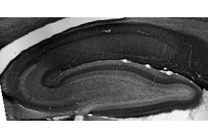 Adult rat hippocampus immunohistochemistry. (Peroxisomal Biogenesis Factor 5-Like (PEX5L) (AA 1-192), (Constant Region) 抗体)