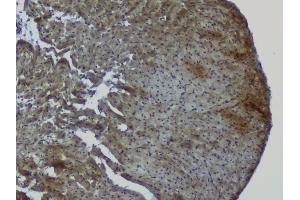 IHC analysis of NRF1 using anti-NRF1 antibody (ABIN6719347).