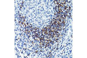 Immunohistochemistry of paraffin-embedded human tonsil using CD79B Rabbit pAb (ABIN3022745, ABIN3022746, ABIN3022747 and ABIN6219206) at dilution of 1:100 (40x lens).