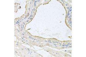 Immunohistochemistry of paraffin-embedded human prostate using HPR antibody (ABIN6003630) at dilution of 1/100 (40x lens). (HPR 抗体)