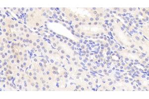 Detection of SOST in Human Kidney Tissue using Polyclonal Antibody to Sclerostin (SOST) (Sclerostin 抗体  (AA 25-213))