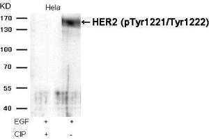 Western blot analysis of extracts from Hela cells, treated with EGF or calf intestinal phosphatase (CIP), using HER2 (Phospho-Tyr1221/Tyr1222) Antibody. (ErbB2/Her2 抗体  (pTyr1221, pTyr1222))