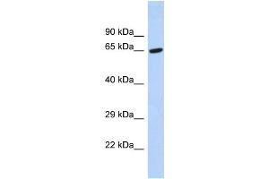 Host:  Rabbit  Target Name:  TAF6L  Sample Type:  Hela whole cell lysates  Antibody Dilution:  1. (TAF6L 抗体  (C-Term))