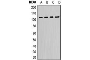 Western blot analysis of PI3K p110 delta expression in K562 (A), Raji (B), Raw264. (PIK3CD 抗体  (C-Term))