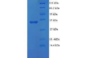 Ubiquitin-Conjugating Enzyme E2D 3 (UBE2D3) (AA 1-147), (full length) protein (His-SUMO Tag)