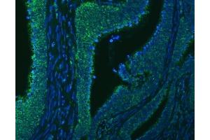 IF analysis of SLC20A1 using anti-SLC20A1 antibody (ABIN7602463).