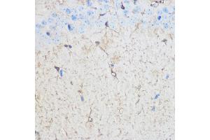 Immunohistochemistry of paraffin-embedded Mouse brain using S100B Rabbit pAb (ABIN3021047, ABIN3021048, ABIN3021049, ABIN1513496 and ABIN6213928) at dilution of 1:100 (40x lens). (S100B 抗体  (AA 1-92))