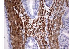 Image no. 7 for anti-Tuberous Sclerosis 1 (TSC1) (AA 836-1164) antibody (ABIN1491685)