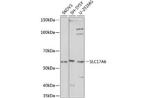 Western blot analysis of extracts of various cell lines, using SLC17 Polyclonal Antibody (ABIN7270407) at 1:1000 dilution. (Solute Carrier Family 17 (Vesicular Glutamate Transporter), Member 6 (SLC17A6) (C-Term) 抗体)