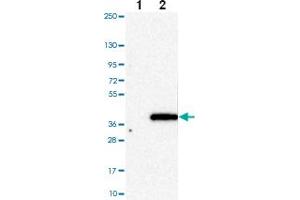 Western blot analysis of Lane 1: Negative control (vector only transfected HEK293T lysate) Lane 2: Over-expression Lysate (Co-expressed with a C-terminal myc-DDK tag (~3. (HAPLN2 抗体)