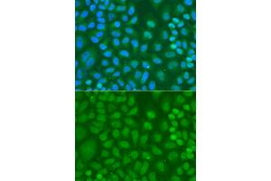 Immunofluorescence analysis of HeLa cells using CXXC1 antibody. (CXXC1 抗体)