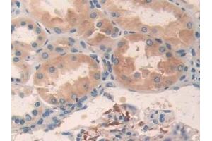 Immunohistochemistry (IHC) image for anti-Protein Kinase, AMP-Activated, alpha 2 Catalytic Subunit (PRKAA2) (AA 252-493) antibody (ABIN7443308)