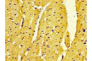 IHC image of ABIN7160623 diluted at 1:500 and staining in paraffin-embedded human heart tissue performed on a Leica BondTM system. (DMPK 抗体  (AA 243-424))