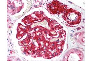 Image no. 1 for anti-Telomeric Repeat Binding Factor 2, Interacting Protein (TERF2IP) (AA 2406-2419) antibody (ABIN302914) (RAP1 抗体  (AA 2406-2419))