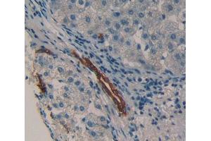 IHC-P analysis of Kidney tissue, with DAB staining. (HCK 抗体  (AA 2-526))