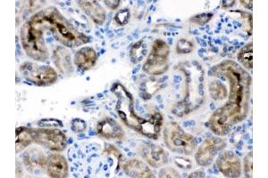 IHC testing of FFPE mouse kidney with TCP1 delta antibody. (CCT4 抗体)