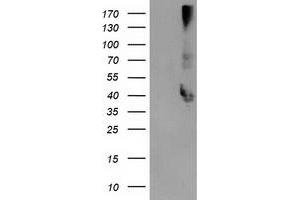 Western Blotting (WB) image for anti-Microtubule-Associated Protein, RP/EB Family, Member 2 (MAPRE2) antibody (ABIN1499318) (MAPRE2 抗体)