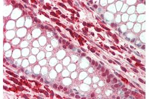 Rabbit Anti-Snai3 antibody Catalog Number: ARP37207 Formalin Fixed Paraffin Embedded Tissue: Human Colon Primary antibody Concentration: 1:200 Secondary Antibody: Donkey anti-Rabbit-Cy3 Secondary Antibody Concentration: 1:200 Magnification: 20x Exposure Time: 0. (SNAI3 抗体  (N-Term))