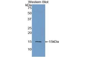 Detection of Recombinant CST3, Human using Polyclonal Antibody to Cystatin C (Cys-C) (CST3 抗体  (AA 27-146))