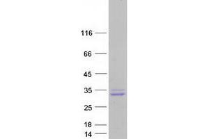 Western Blotting (WB) image for NK2 Homeobox 6 (NKX2-6) protein (Myc-DYKDDDDK Tag) (ABIN2727354)