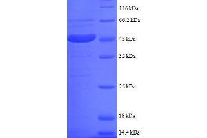 Ubiquitin-Conjugating Enzyme E2I (UBE2I) (AA 1-157), (partial) protein (GST tag) (UBE2I Protein (AA 1-157, partial) (GST tag))