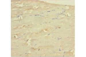Immunohistochemistry of paraffin-embedded human skeletal muscle tissue using ABIN7159662 at dilution of 1:100 (WDR77 抗体  (AA 1-312))