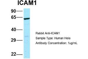 Host: Rabbit  Target Name: ICAM1  Sample Tissue: Human Hela  Antibody Dilution: 1. (ICAM1 抗体  (N-Term))