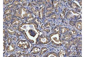 IHC analysis of TOLLIP using anti-TOLLIP antibody (ABIN7599202).