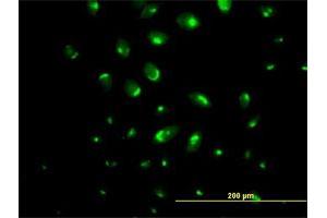 Immunofluorescence (IF) image for anti-ATPase, Ca++ Transporting, Type 2C, Member 1 (ATP2C1) (AA 1-919) antibody (ABIN525805)