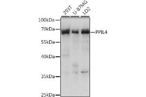Western blot analysis of extracts of various cell lines, using PPIL4 antibody (ABIN7269212) at 1:1000 dilution. (PPIL4 抗体  (AA 301-492))