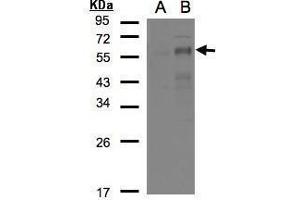 WB Image Western Blot analysis of EGR2 expression in transfected 293T cell line by EGR2 polyclonal antibody. (EGR2 抗体)