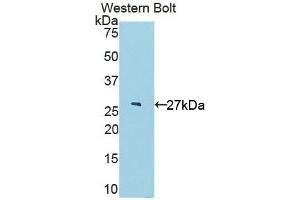 Detection of Recombinant IL22Ra2, Rat using Polyclonal Antibody to Interleukin 22 Receptor Alpha 2 (IL22Ra2) (IL22RA2 抗体  (AA 30-228))