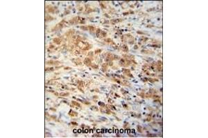 Immunohistochemistry (Paraffin-embedded Sections) (IHC (p)) image for anti-Peroxiredoxin 1 (PRDX1) (AA 88-116) antibody (ABIN389467)