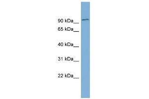 WB Suggested Anti-FBXO34 Antibody Titration: 0. (FBXO34 抗体  (Middle Region))
