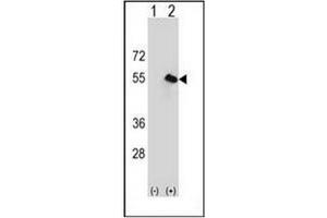 Western blot analysis of CPN1 (arrow) using CPN1 Antibody (Center) Cat. (CPN1 抗体  (Middle Region))